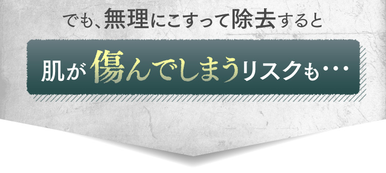 でも、無理にこすって除去すると肌が傷んでしまうリスクも…