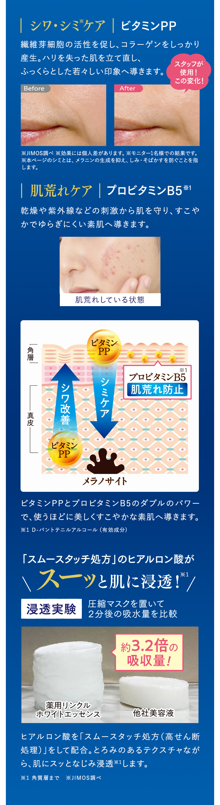 シワ・シミケア | ビタミンPP　肌荒れケア | プロビタミンB5　「スムースタッチ処方」のヒアルロン酸がスーッと肌に浸透！
