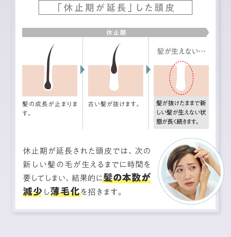 「休止期が延長」した頭皮